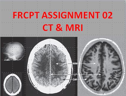 FRCPT Assignment 02: CT Scan & MRI