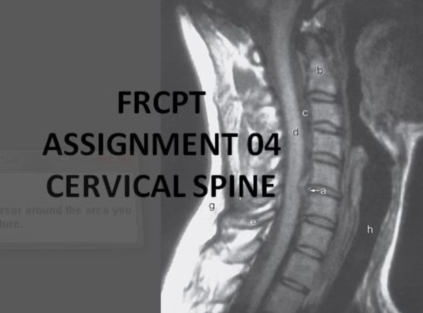 FRCPT Assignment 01: Cervical Spine