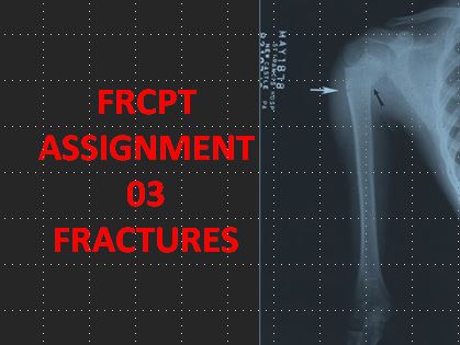 FRCPT Assignment 03: Fractures